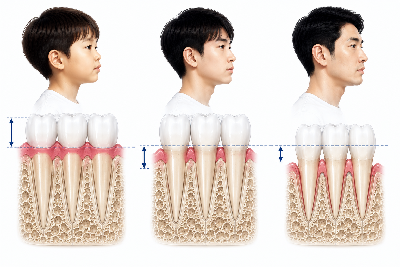 신풍역 치과 성인교정 — 소아·청소년·성인 교정의 치료 설계 관점 차이 이미지 (1200x900px)